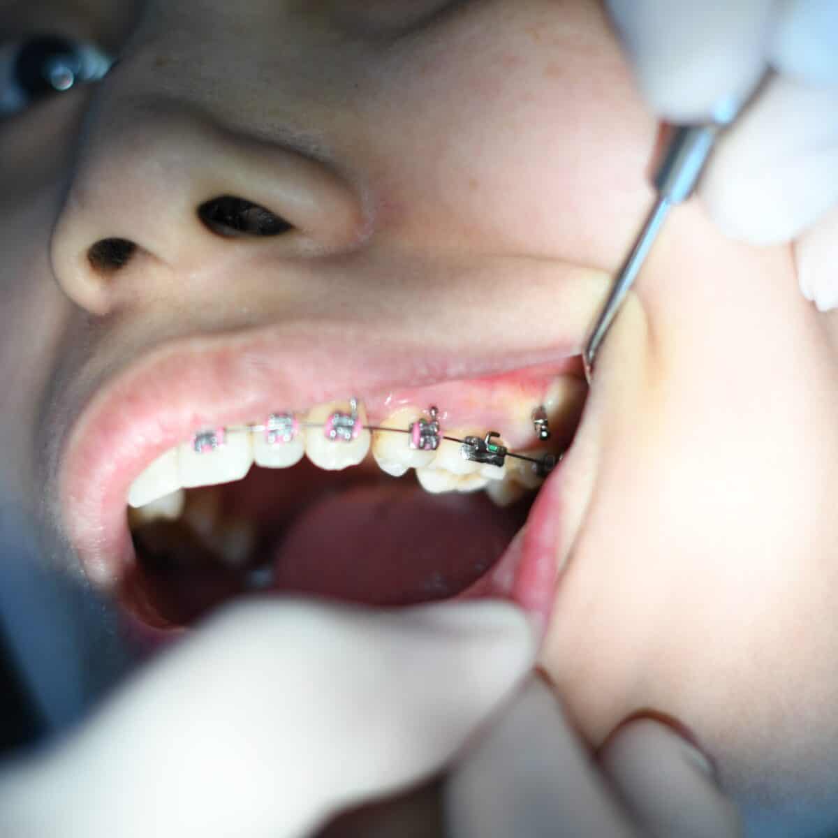 dental checkups
