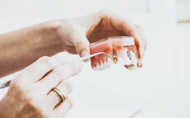 What is a dental emergency │Hermes London Dental Clinic